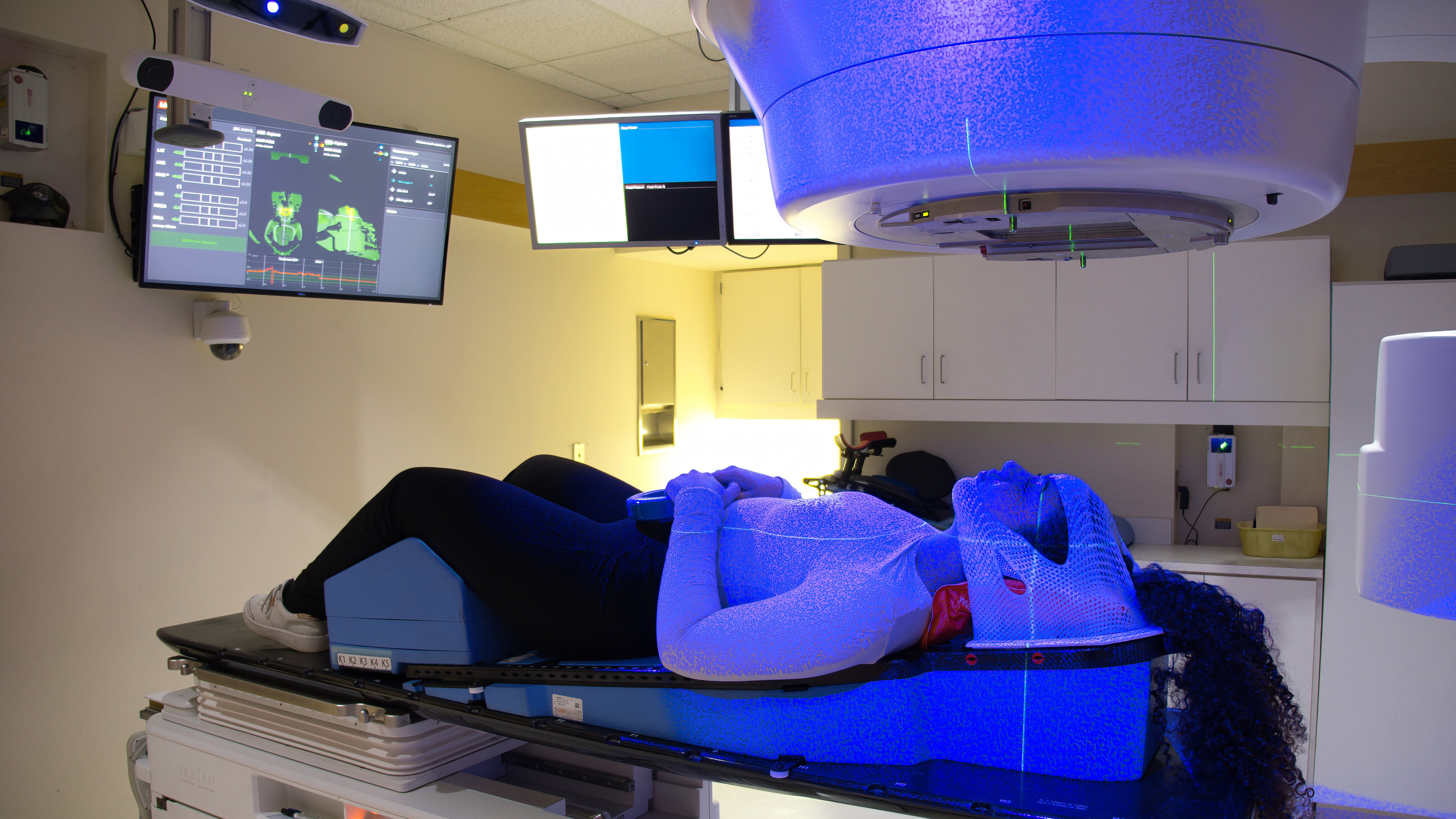 Masques ouverts et SGRT en radiothérapie