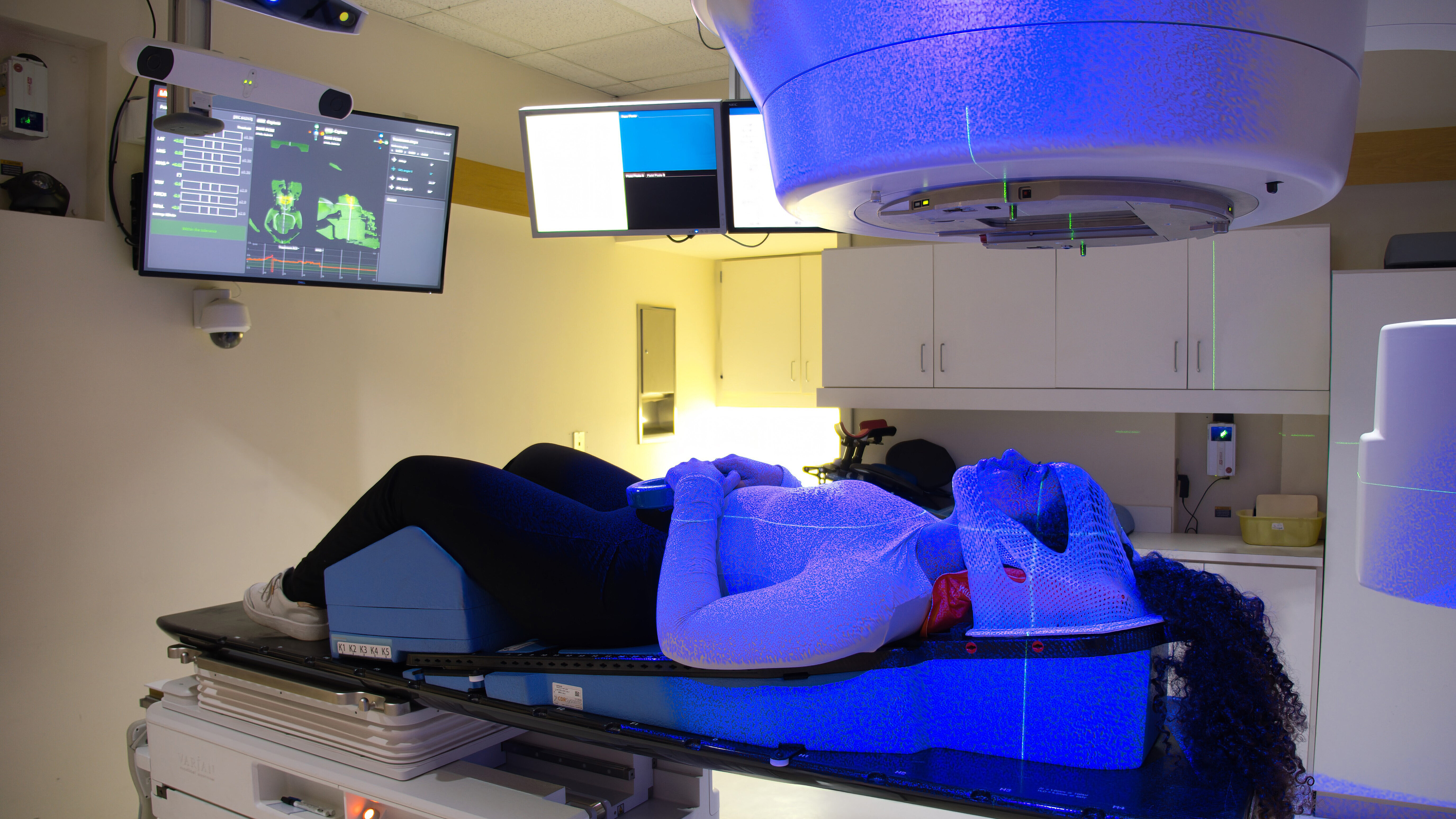 Máscaras abiertas y SGRT en radioterapia