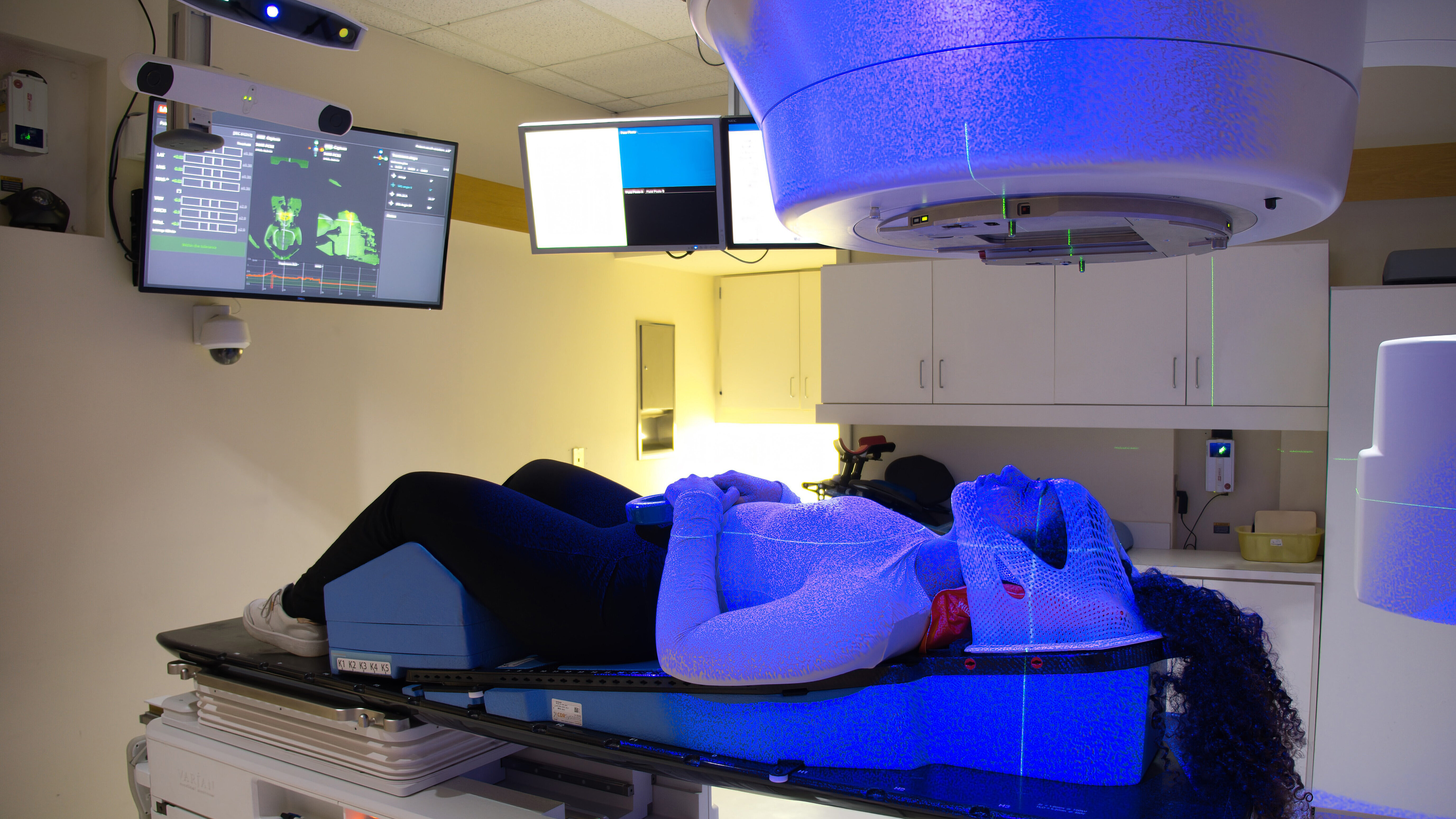 Offene Gesichtsmasken und SGRT in der Strahlentherapie