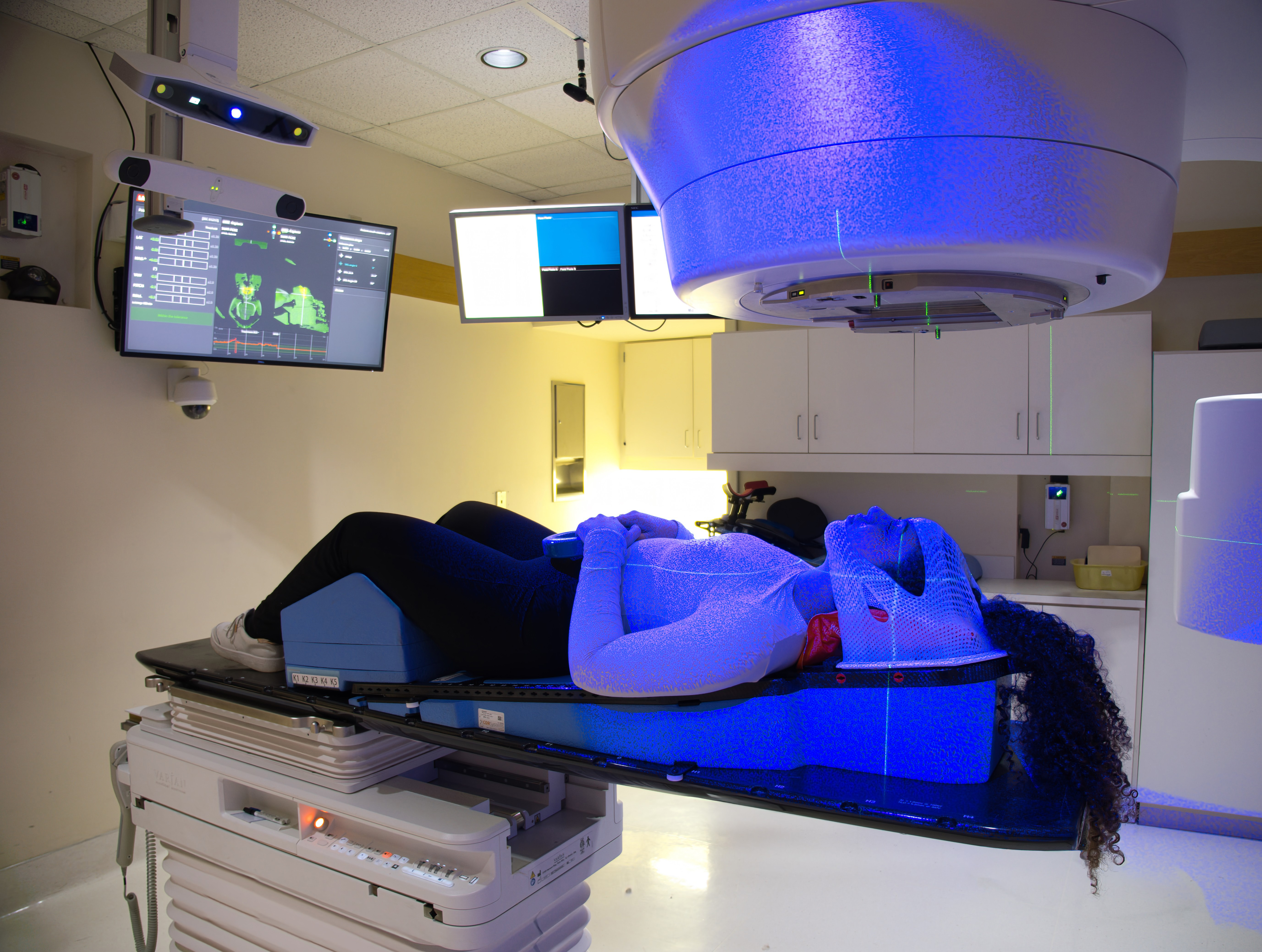 Open-face masks with Surface Guided Radiation Therapy