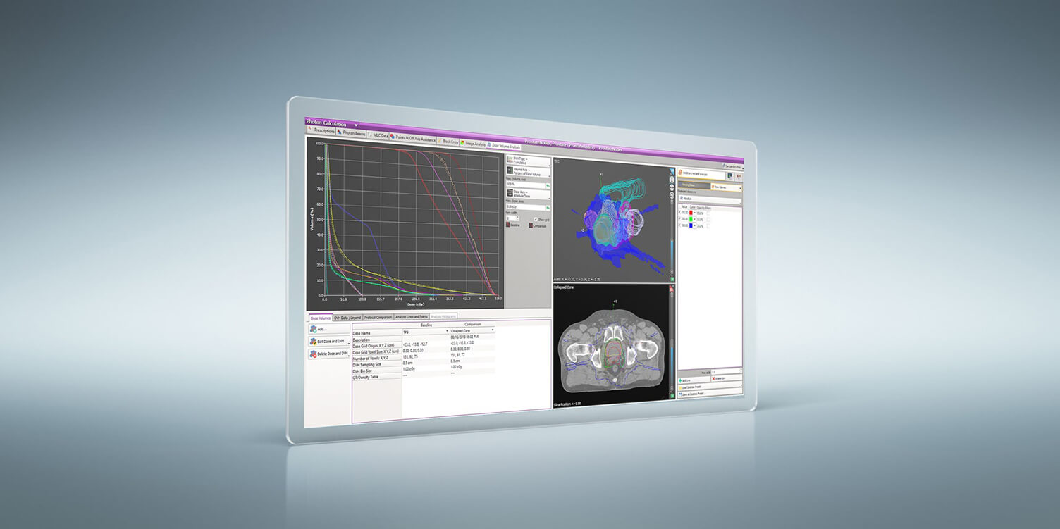 Advancing patient-centric QA – Dosimetry Check™ fully ported to RadCalc 7.2