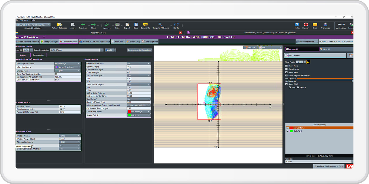 IMRT Treatment Plans
