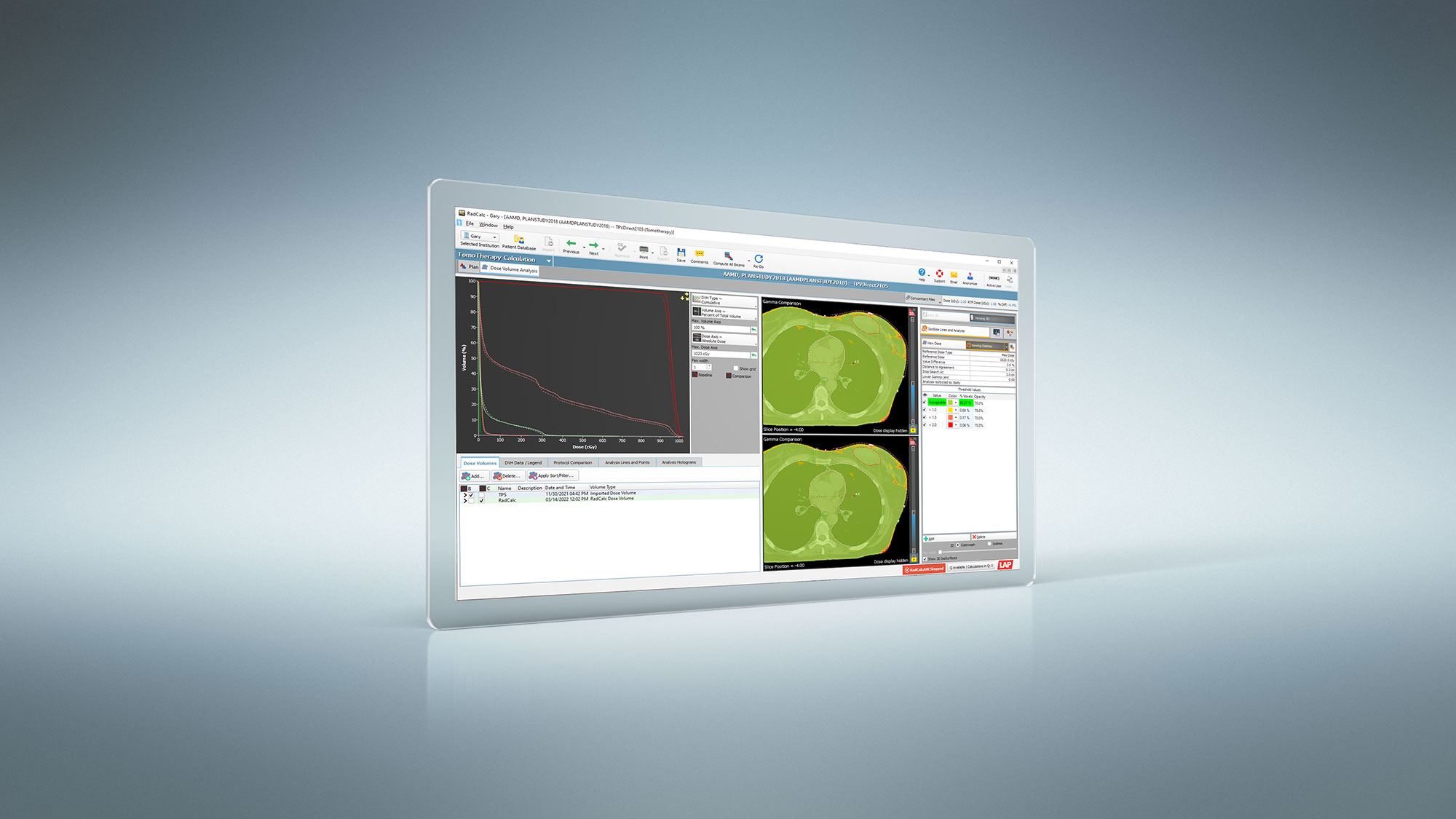 Webinar: Automated patient QA using RadCalc software for helical tomotherapy treatments at the University Hospital Cologne